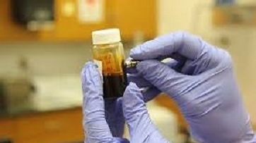 Ricerca Sanitaria Finalizzata 