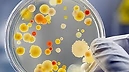 Antibiotico resistenza ed Infezioni correlate all'assistenza